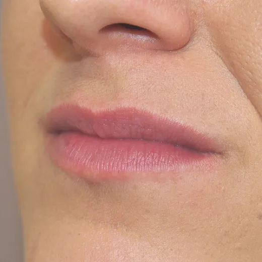 Image before