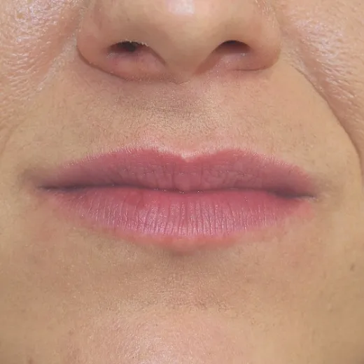 Image before