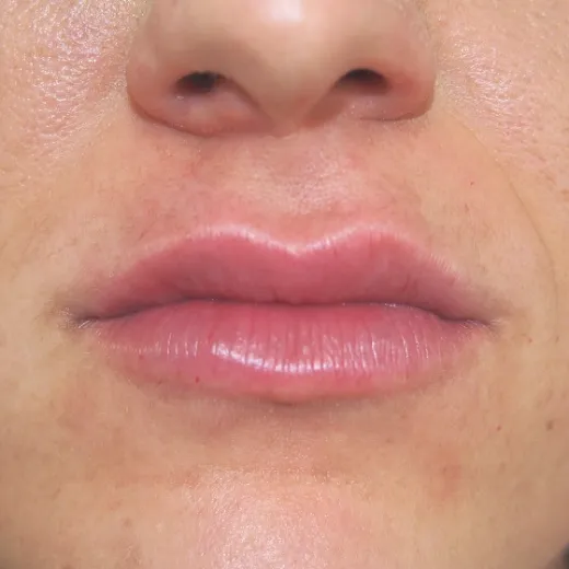 Image after