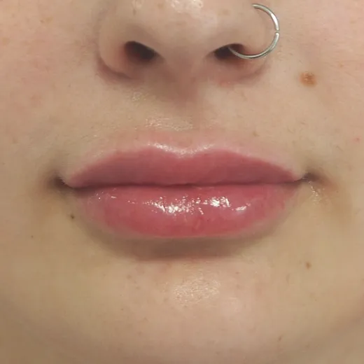 Image after
