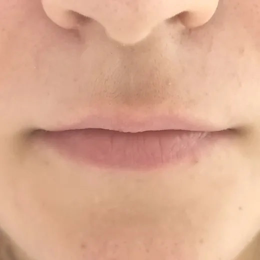 Image before