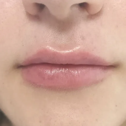 Image after