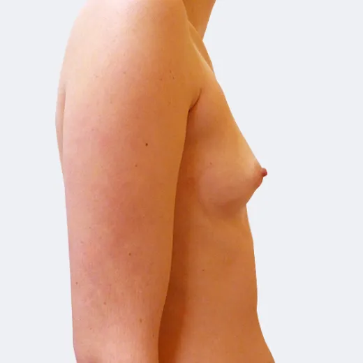Image before