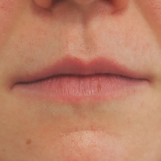 Image before