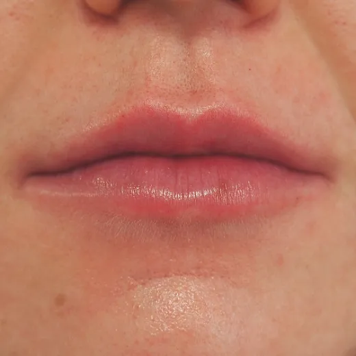 Image after