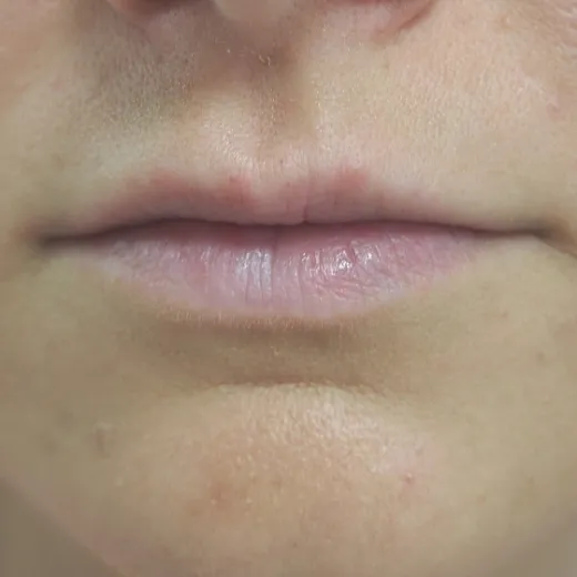 Image before