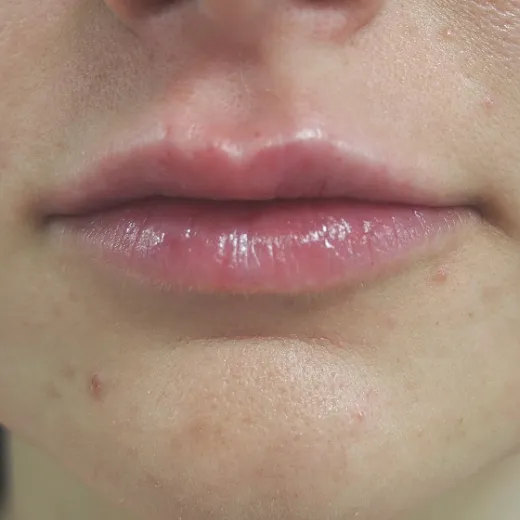 Image after