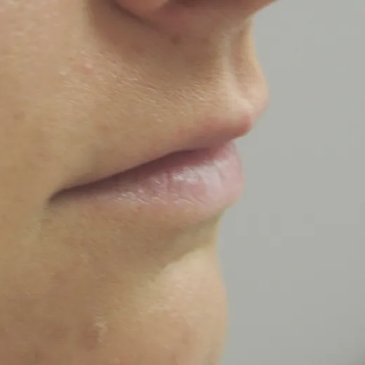 Image before