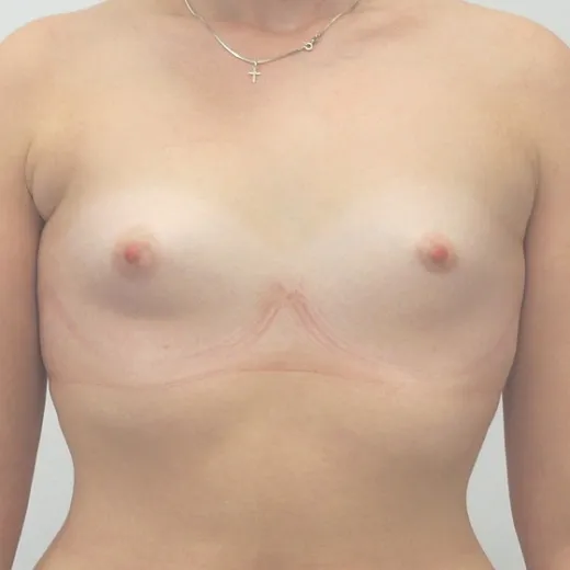 Image before