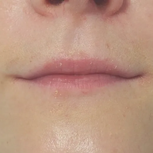 Image before