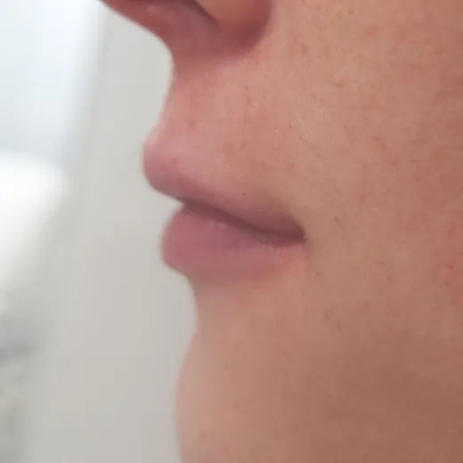 Image after