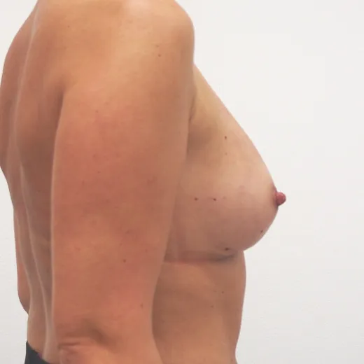 Image after