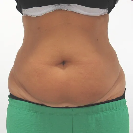 Image before