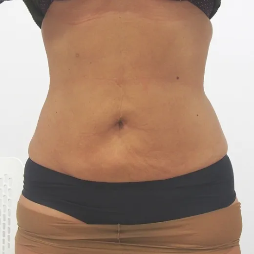 Image after