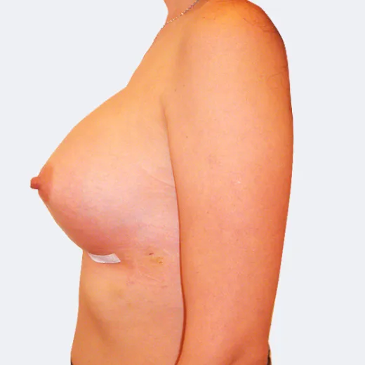 Image after
