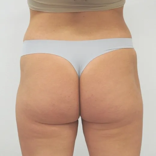 Image before