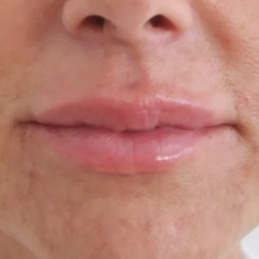 Image after