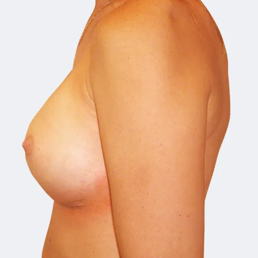 Image after