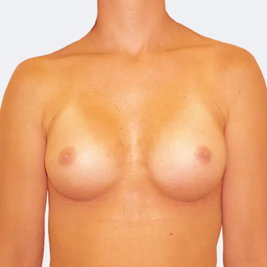 Image after