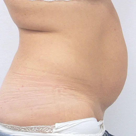 Image before