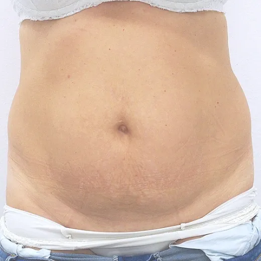 Image before