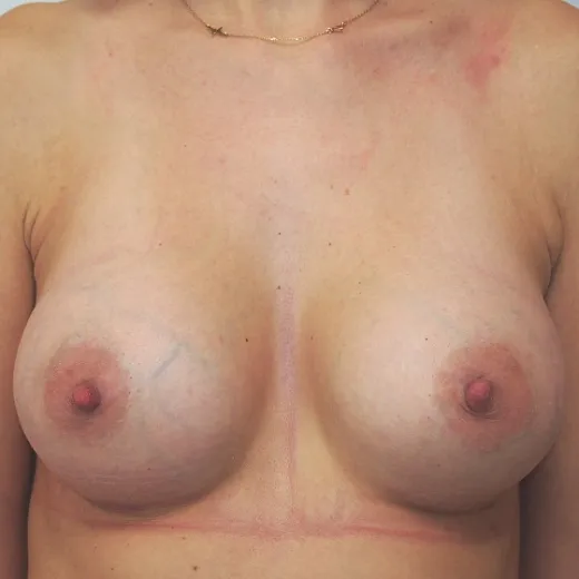 Image after