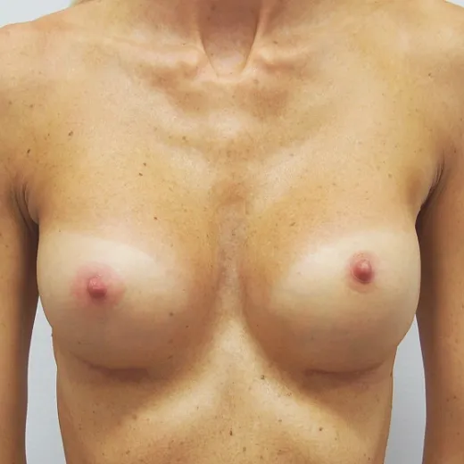 Image after