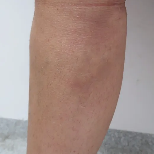 Image after