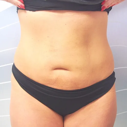 Image after