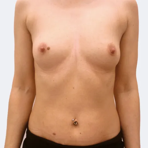 Image before