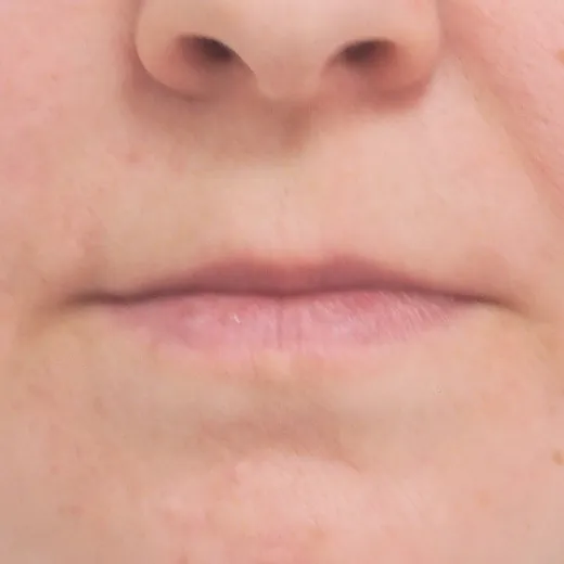 Image before