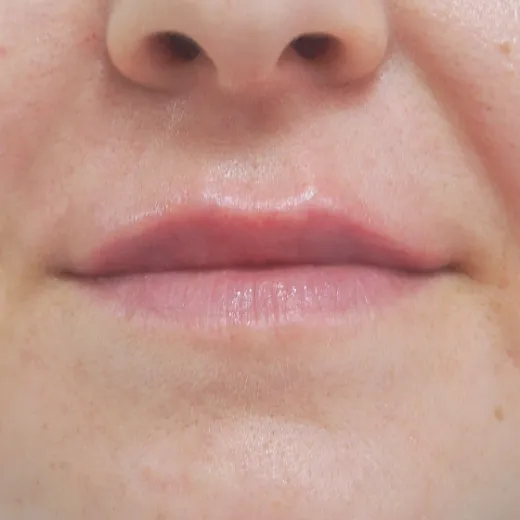 Image after