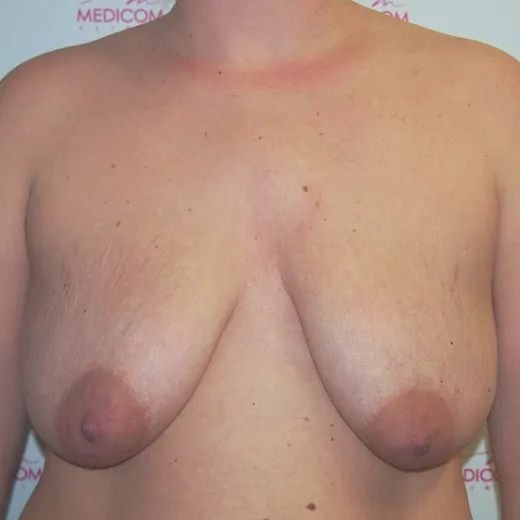 Image before