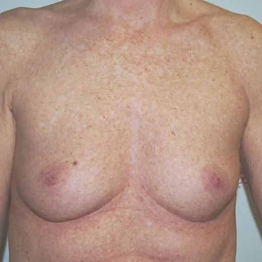 Image before