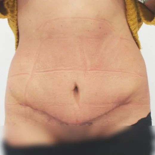 Image after