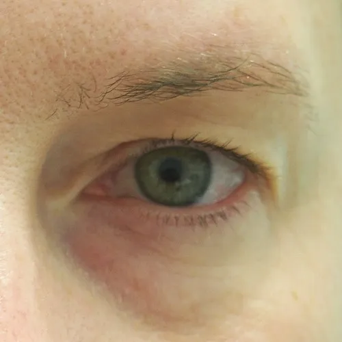 Image before