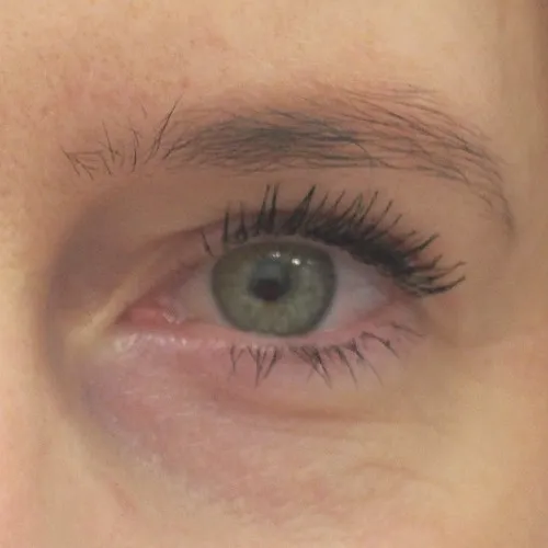 Image after