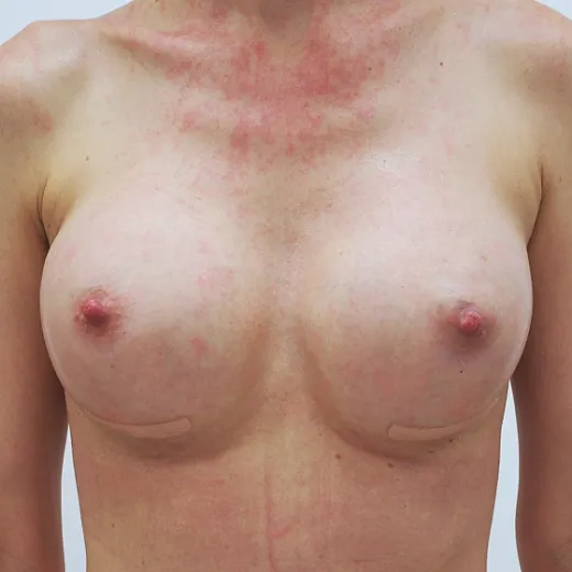 Image after