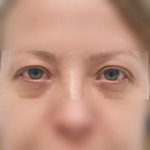 Image before