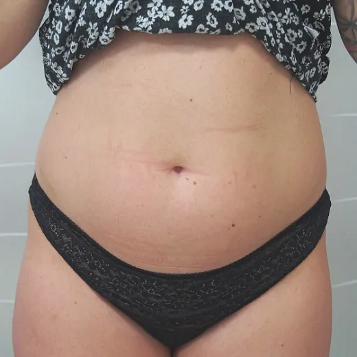 Image before