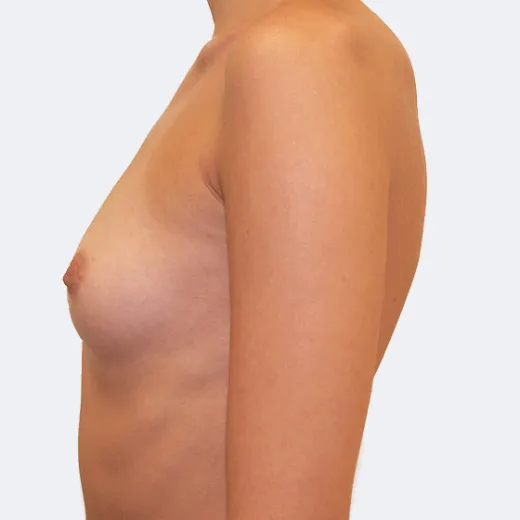 Image before