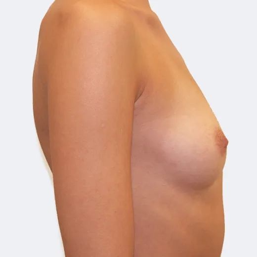 Image before