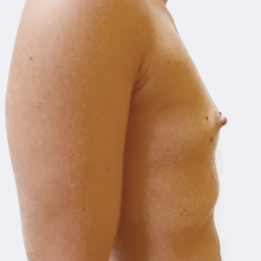 Image before
