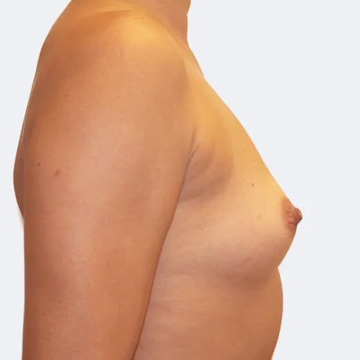 Image before