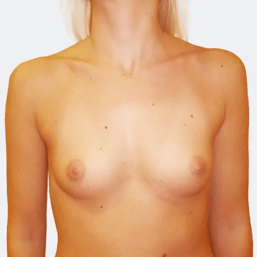 Image before