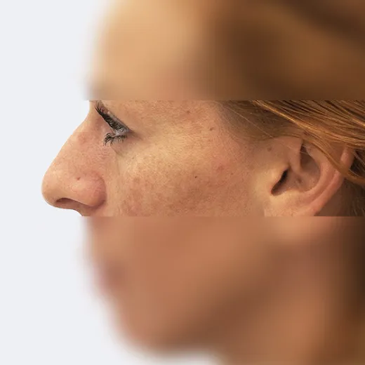 Image before