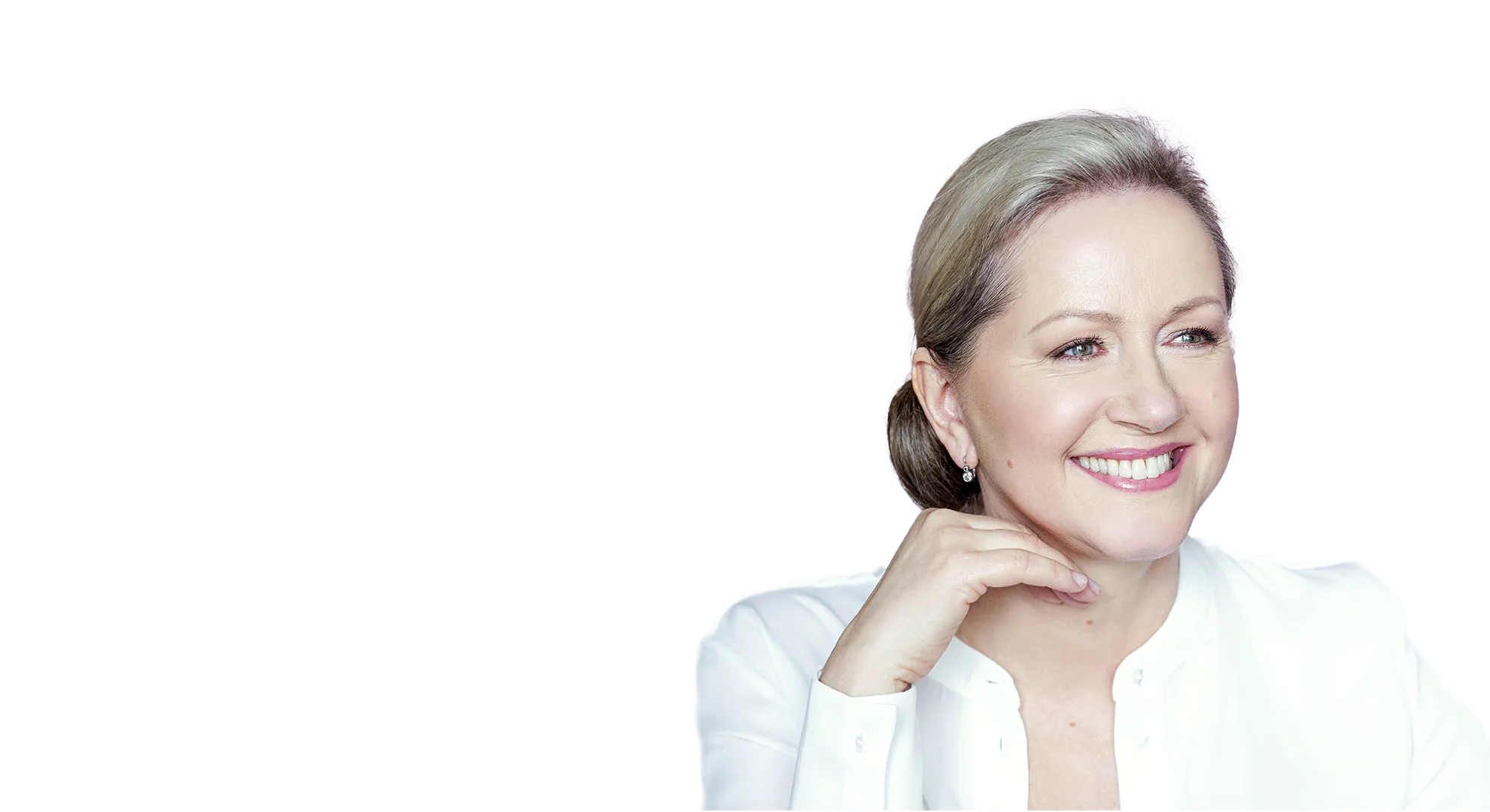 Mrs. Lucie 56 - MyFaceLift Facial Rejuvenation