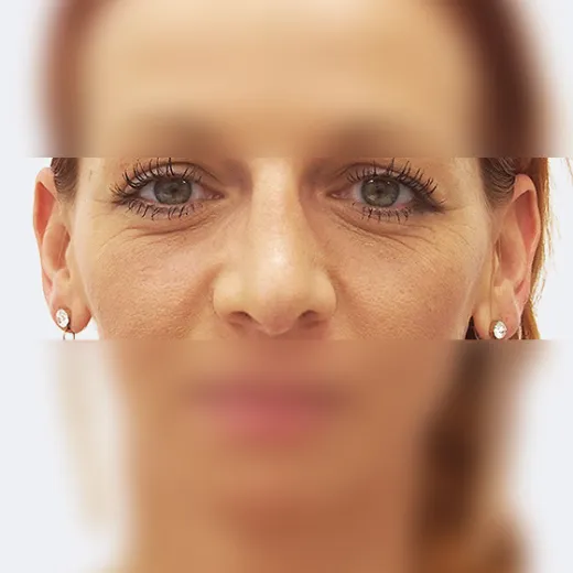 Image after