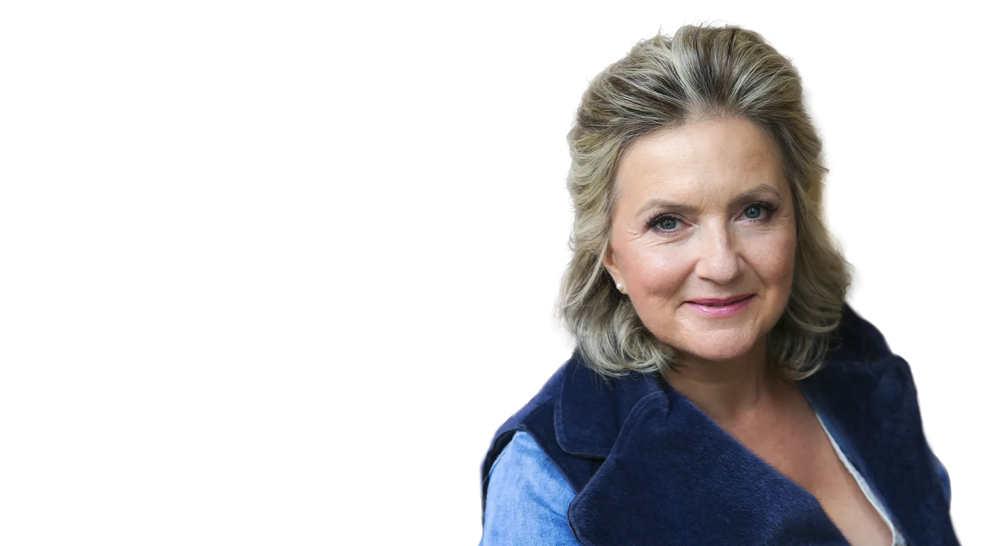 Mrs. Jitka 56 - Facelift and necklift with upper and lower eyelid surgery