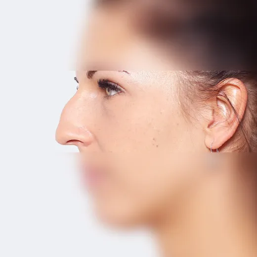 Image before